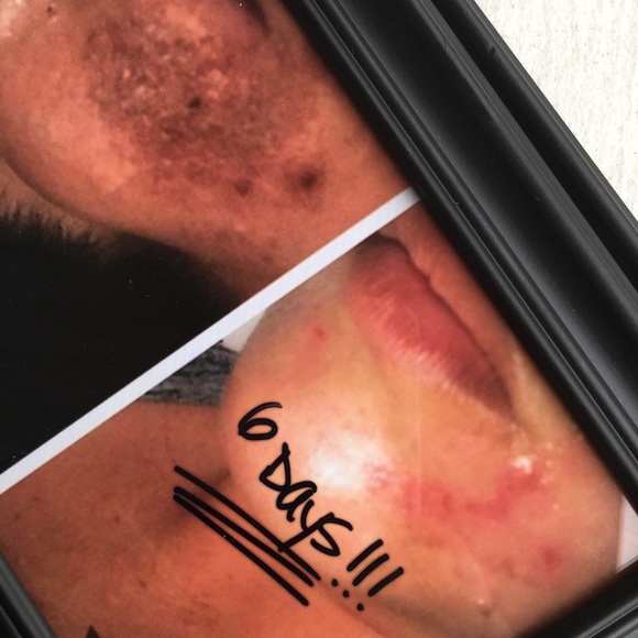 ❤️‍🩹🛍MIRACLE HEALING BALM #cureall, BEST IN BEAUTY PICK! #elevatedskincare - Picture 7 of 16